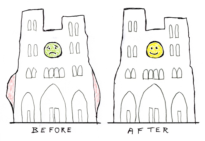 before-after