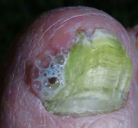 IMG_5589_rot-4.1_crop.3_280x260